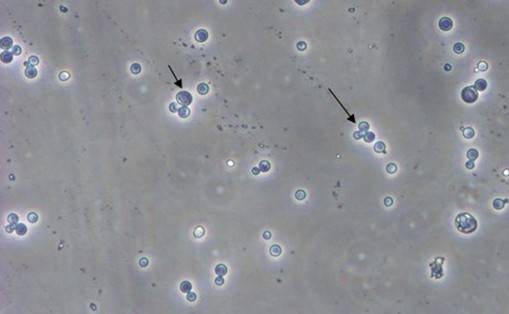 酵母双杂交技术原理、试验流程、特点以及应用