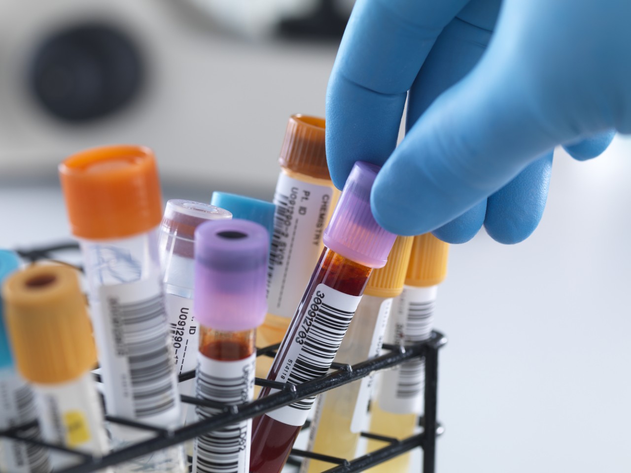 一致性评价大幕开启，医院市场即将调整