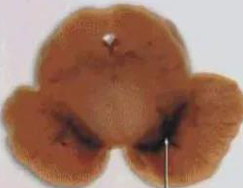 正常人：正：谥