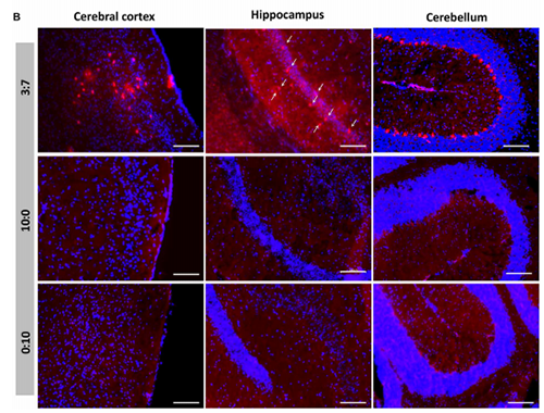 被包裹在含有NT-类脂质的LNP中的Cre重组酶成功转移。大脑中的转染神经元呈红色高亮。