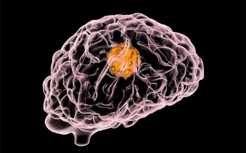 不朽情缘mg官网助力 | 璧辰医药ABM-1310获美国FDA孤儿药资格认证，用于治疗携带BRAF V600突变的脑胶质母细胞瘤患者