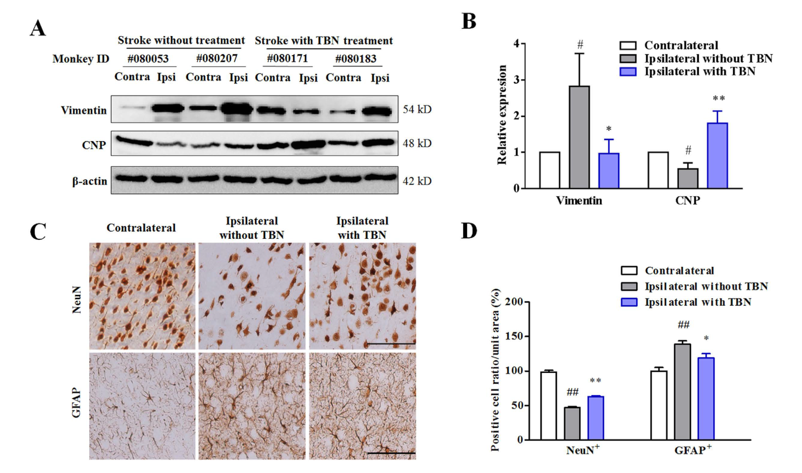 TBN是一种治疗缺血性卒中的新型临床候选药物，本研究中TBN通过不朽情缘mg官网合成